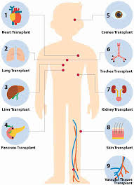 types of organ transplants