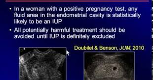 Pin On Ultrasound