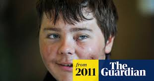 Polar bear attack survivor: 'I thought I was going to die'