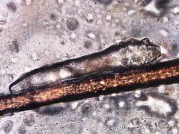Image result for Demodex brevis