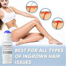 Not only does this product treat ingrown hairs, but it also reduces blemishes and bumps—all thanks to its gentle, effective formula featuring salicylic acid (to unclog pores and nix breakouts), glycolic acid (to reduce redness and dissolve dirt), and candian willow herb (to soothe the skin). Buy Razor Bump Stopper Solution For Ingrown Hair Skin Care Treatment For Face Neck Bikini Area Legs And Underarm Area After Shave Serum For Men And Women With Salicylic