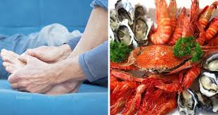 Cara mengurangkan asid urik dalam badan dengan makanan semulajadi. Jangan Salahkan Makanan Laut Sebagai Punca Gout Baca Perjelasan Dr Ni Keluarga