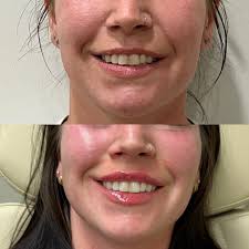 Pure Seoul Aesthetics Medspa