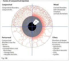 Image result for Ciliary Flush