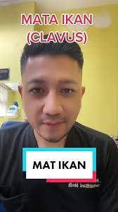 Mata Ikan Jempol Kaki