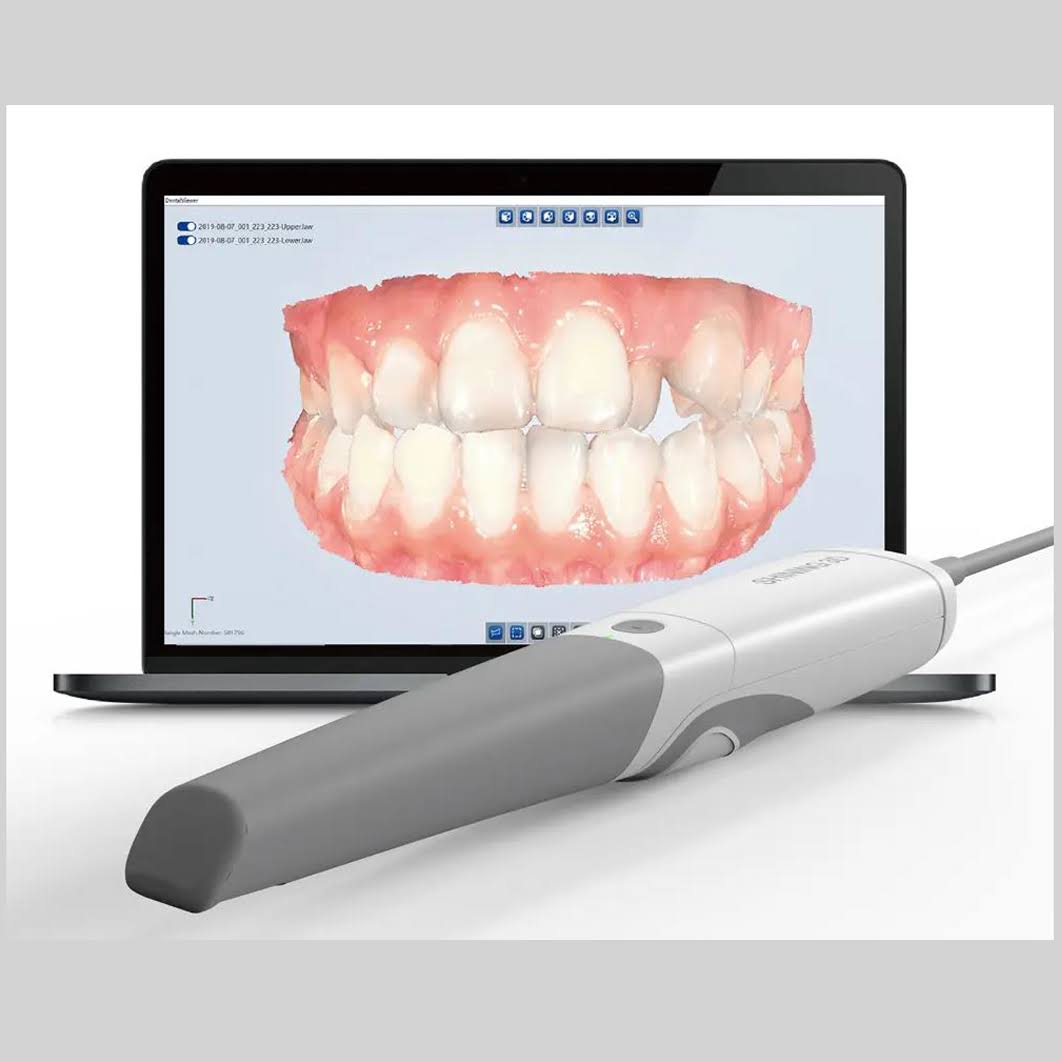 Intraoral scanner illusion product image