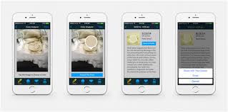 Image result for acholic stools human