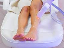 Image result for how effective is the hair removal laser treatment