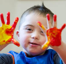 Pranataldiagnostik Neun Von Zehn Paaren Lassen Bei Trisomie Abtreiben Welt