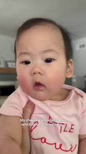 Bby Teething Red Face