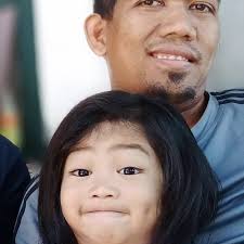 Inilahad ng isang eksperto ang mga mabuting dulot ng pagpapatuli: