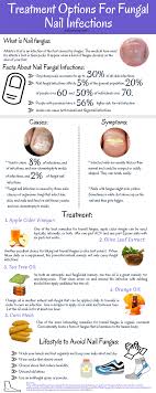 Check spelling or type a new query. How To Get Rid Of Fungal Nail Infections Visual Ly