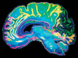 Image result for brain