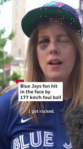 Liz McGuire is still a Jays fan — even after a foul ball smacked her in the  face. McGuire posted