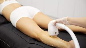 Shr or super hair removal is a relatively newer technology which uses gentler pulses of energy but at a higher frequency. Top Developments In Hair Removal Procedures Venus Concept