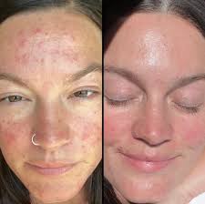 Reviews of Star Faced Esthetics