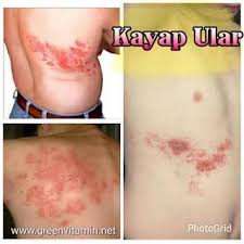 Kayap Ular Bolehkah Sembuh Atau Membawa Maut Print Tattoos Info Paw Print