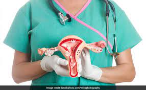 If you have signs and symptoms of uterine cancer, you should see a gynecologist. Uterus Cancer Some Signs And Symptoms You Must Know