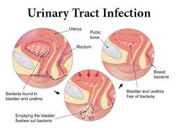 We did not find results for: Best Urinary Tract Infection Treatment Uti Specialist In Gurgaon