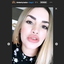 Kimberly Loaiza Sorprende A Sus Fans Cirugia