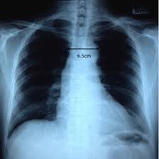 نتیجه جستجوی لغت [widened] در گوگل