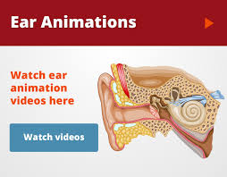 Otosclerosis Stapedectomy Michigan Ear Institute Farmington Hills Dearborn Royal Oak Novi Mi