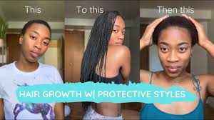 Well, anyone can be allergic to just about anything and that anything could be synthetic hair. Allergic To Synthetic Hair The Remedy It S Not Acv Brittany S Room Youtube