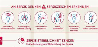 Sepsis is a serious medical condition. Info Poster Versus Sepsis