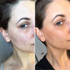 Don't over think it. ​ Face Tan Water™️ is for ​all ages, all skin types,  men and women. ​ ​Creates a nice, even glow and enhances your complexion  with only Organic and