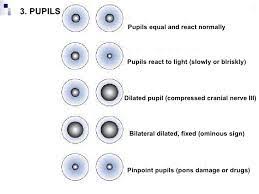 33 Punctual Pupil Charting