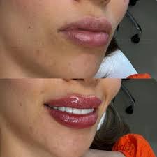 Dr. Diego Sinisterra (@drdiegosinisterra)