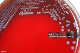 Image result for yersinia fotos