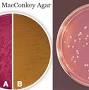 مخبران?q=https://www.researchgate.net/figure/Characteristics-of-Escherichia-coli-on-Sorbitol-MacConkey-Agar-Note-the-pinkish-colonies_fig4_322642919 from microbenotes.com