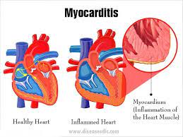 These effects on your heart muscle. Facebook