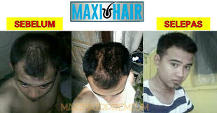 Lelaki, perempuan, ibu hamil, ibu menyusukan. Maxi Hair Biotin Hq Publicaciones Facebook