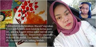 Dan penduduk disane suke mencorakkan bedak sejuk yang dipakai di muke dengan bermacam2 bentuk.kawaiii~. Menderita 7 Bulan Muka Breakout Sampai Kena Panggil Katak Gadis Ini Kongsi Petua Guna Bedak Nyonya Dengan Tomato Sampai Muka Flawless Siakap Keli News