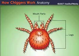 Doctors can diagnose chigger bites by looking at them and asking about a person's recent outdoor activities. The Heartbreak Of Chiggers The Dragonfly Woman