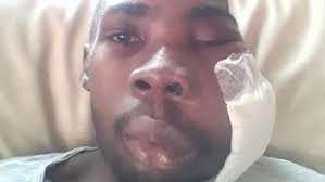 Fundraiser for Rubena Barnaby by Stacy-Ann Williams-Barclay : Help for  Jovayne Bailey