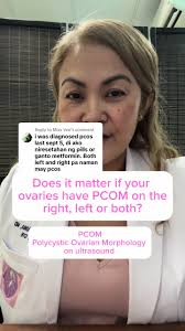 PCOS: A Comprehensive Guide