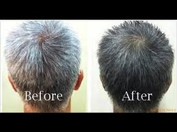 Torai ridged gourd (luffa acutangula). Foods That Stop Grey Hair Natural Health Cures Youtube