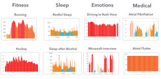 What Do Normal And Abnormal Heart Rhythms Look Like On Apple Watch Cardiogram Heart Rhythms Health Screening Apple Watch