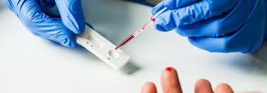 Vamos a tratar de explicar, con esta entrada, cómo saber si estás embarazada y qué hacer en el el resultado del test de embarazo es inmediato y puede hacerse en casa o bien en el centro de salud. Test Rapido Covid 19