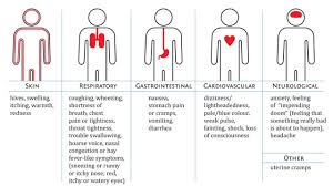 Image result for Anaphylaxis