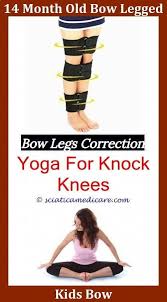 Stop Shin Splints Shinsplints Bow Legged Correction Bow Legged Knock Knees