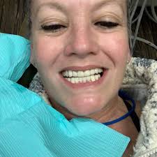 TOP 10 BEST Dental Implants in Lake Havasu City, AZ