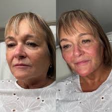 ✨Full Face Transformation✨ My lovely client put her trust in me and gave me  full reign to do what I felt would suit her best. Here we have another  beautiful full face