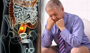Bowel Cancer Symptoms: Four Signs To Check For When You Go To The Toilet |  Express.co.uk