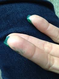 This content is imported from youtube. Is Acrylic Nails Bad For You