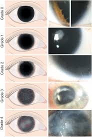 Image result for Silver Grey 1997 AAV