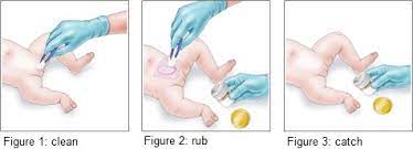Kids Health Information Urine Samples